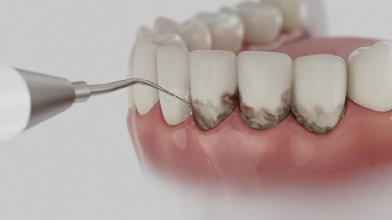 Trusted Dental Implants service in Deerfield, MI - Dentist Open Now